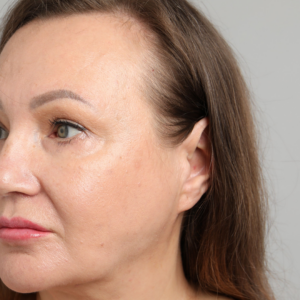 Programa de regeneración & reestructuración facial avanzada